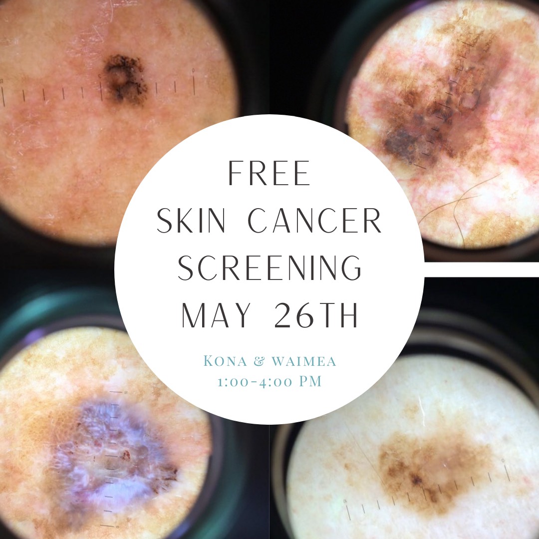Free Skin Cancer Screening Dr Monica Scheel Dermatology Kailua Kona Hi
