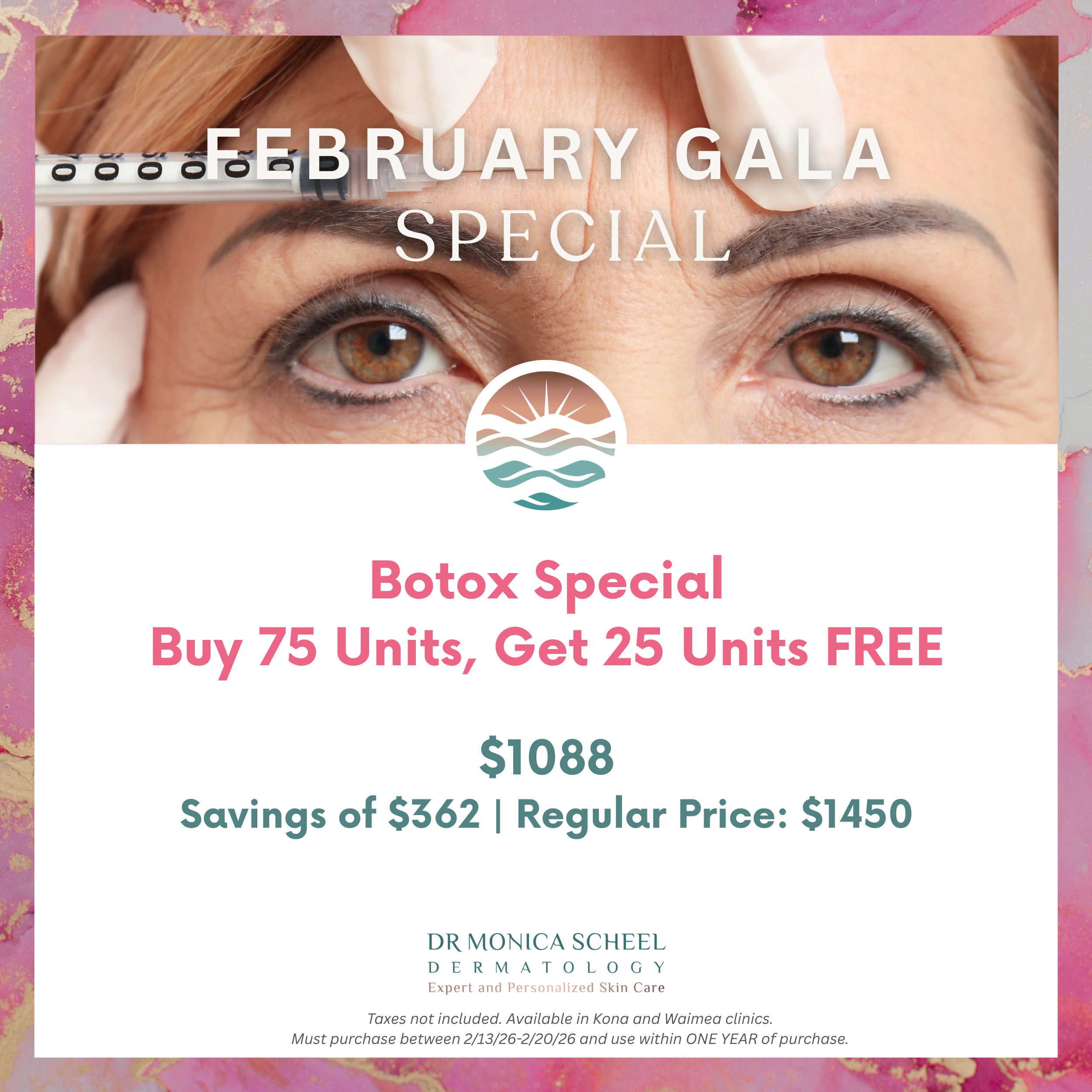 Buy 75 Units of Botox, Get 25 Units Free