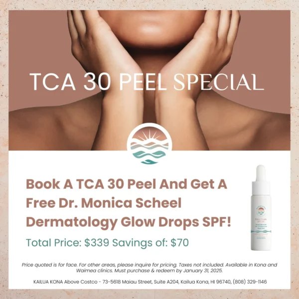 TCA 30 Peel Special - FREE Glow Drops SPF