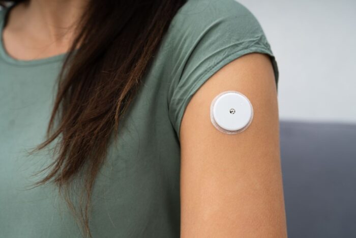 Nutritional Consultation with Continuous Glucose Monitoring