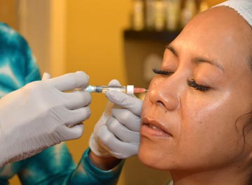 Cosmetic dermatology injection into cheek