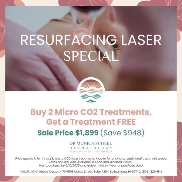 Buy 2 Micro CO2 Treatments, Get a Treatment FREE