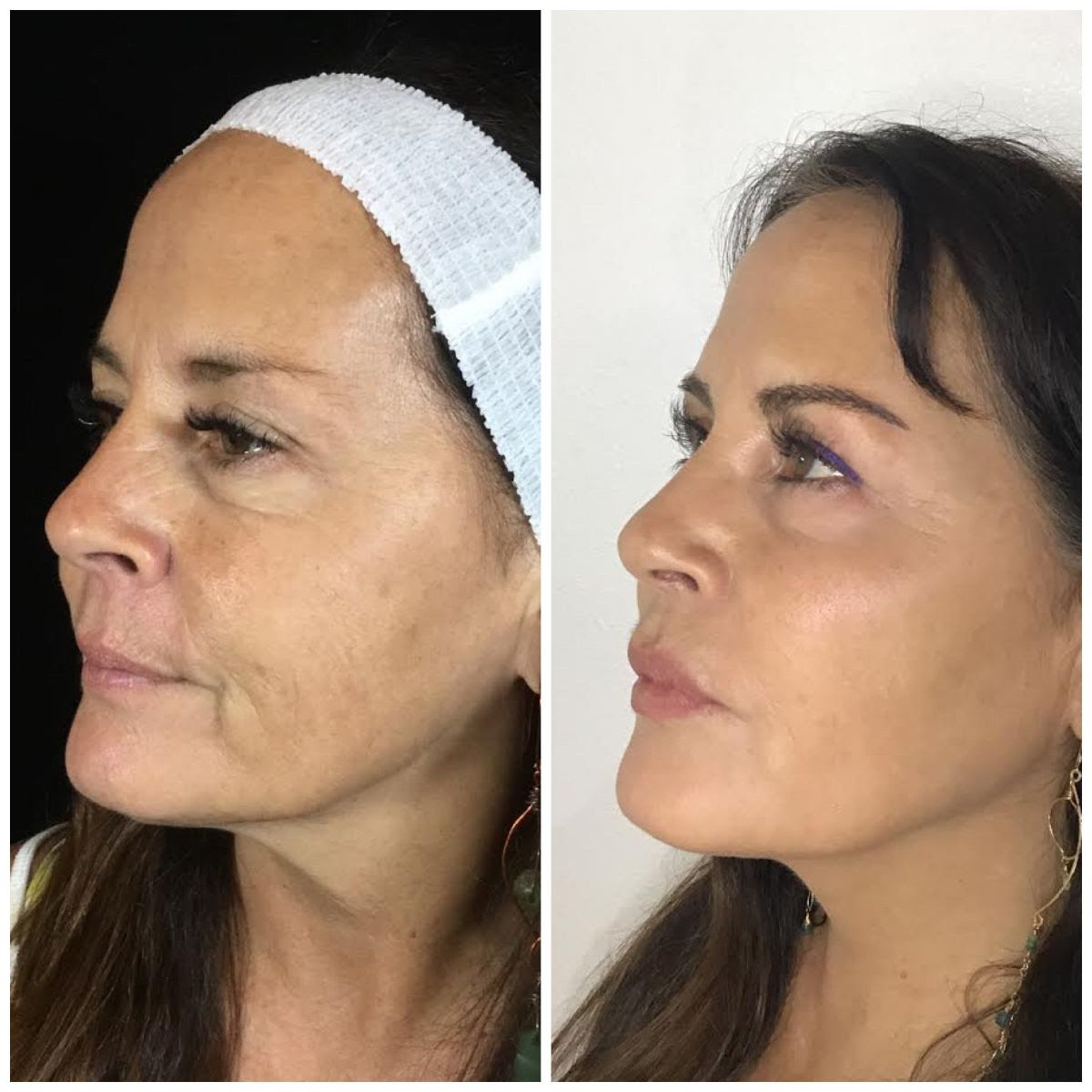 Beauty in Bloom Elevate Your Glow with 'Need a Pick Me Up? Here's a